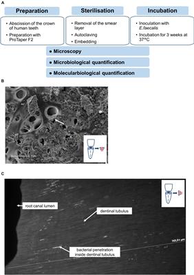 Quantification of Bacterial Colonization in Dental Hard Tissues Using Optimized Molecular Biological Methods